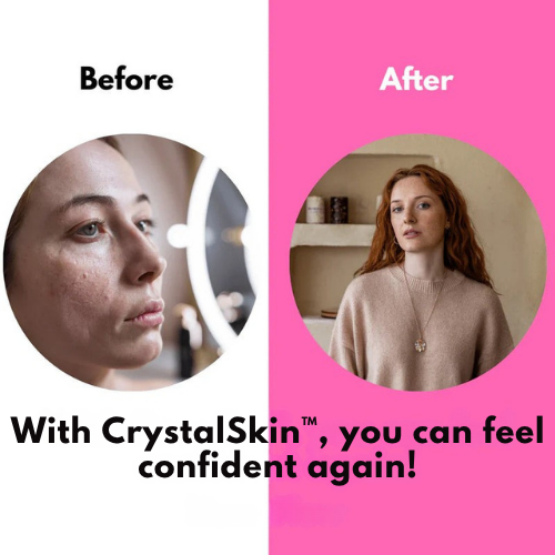 CrystalSkin™ – Une Peau Lisse et Éclatante Inspirée de la Corée du Sud