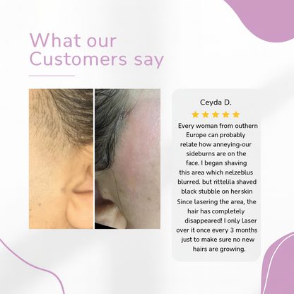 ✨ Ylvis IPL Hair Remover – Smooth, Hair-Free Skin from Home