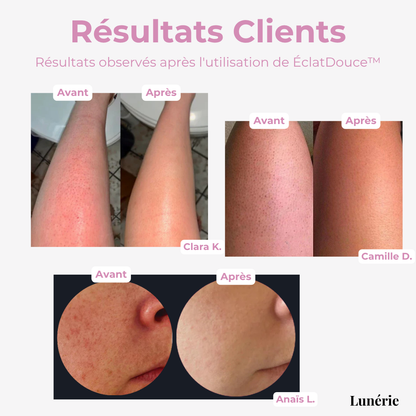 1 + 2 GRATUIT | ÉclatDouce™ Éponge Exfoliante pour le Corps