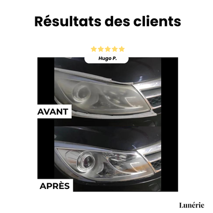 Dernier Jour -50% | ClearView™ Liquide de réparation pour phares