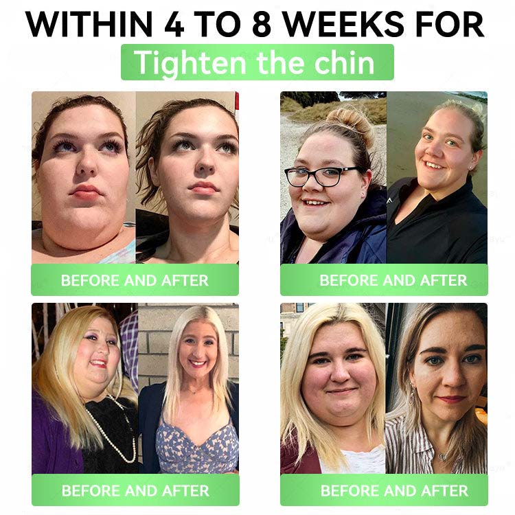 Moringa × Berberine × AMPK 8-Benefit Slimming & Metabolic Nano Microneedle Patch