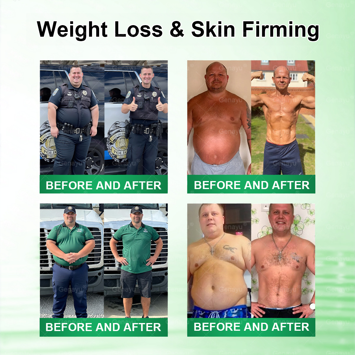 Moringa × Berberine × AMPK 8-Benefit Slimming & Metabolic Nano Microneedle Patch