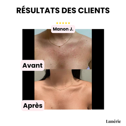 Dernier Jour -50% | CoverLuxe™ Fond de teint corps haute couvrance