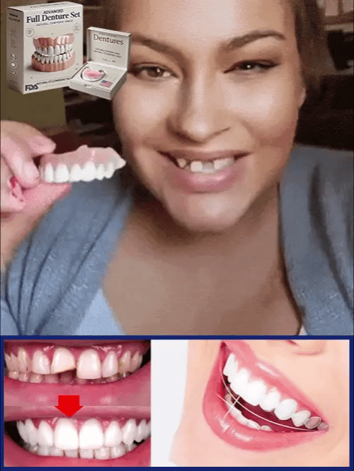 Premium Denture Set | Custom Mold Fit | Natural-Look False Teeth | Comfortable All-Day Wear