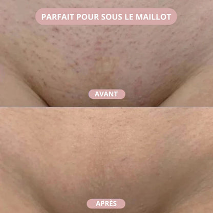 Éclat de Soie™ | Rasoir 2-en-1 pour femme pour une peau douce et soignée