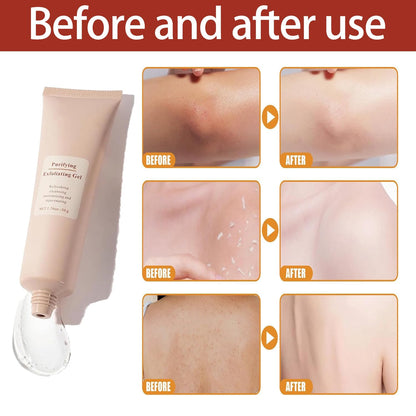 GlowReveal™ Exfoliating Gel – Une Peau Éclatante En 1 Minute