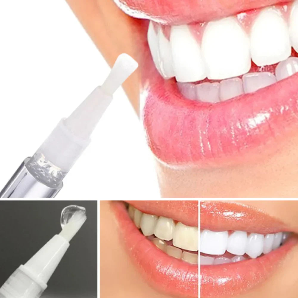 BrightBeam™ Whitening Pen – Un Sourire Éclatant en 10 Minutes