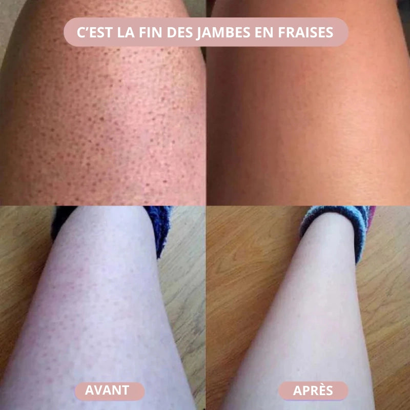Éclat de Soie™ | Rasoir 2-en-1 pour femme pour une peau douce et soignée