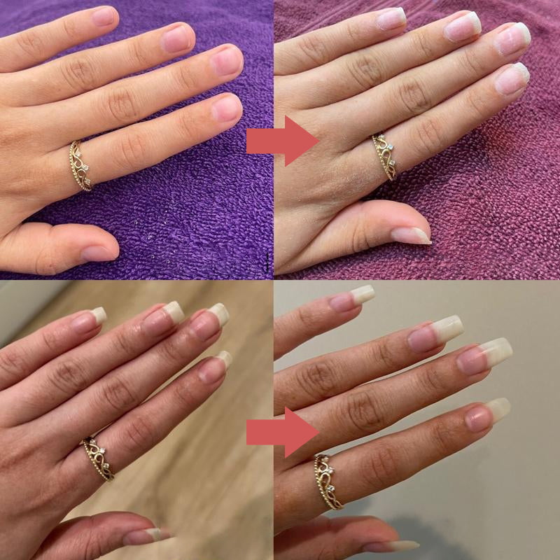 Nail Growth Oil | Moisturizing & Strengthening Formula | Vitamin E & Biotin | 0.17 oz