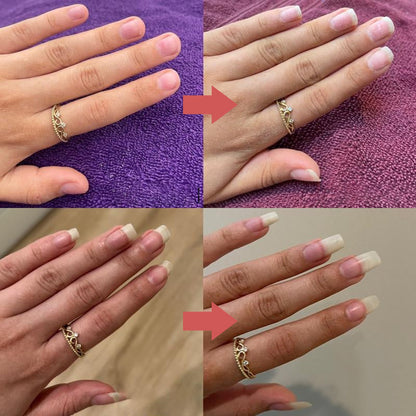 Nail Growth Oil | Moisturizing & Strengthening Formula | Vitamin E & Biotin | 0.17 oz