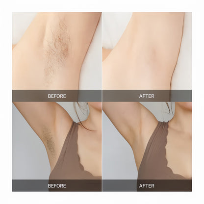 FlawlessBeam™ – Une Peau Douce Sur Tout Le Corps, Sans Irritation