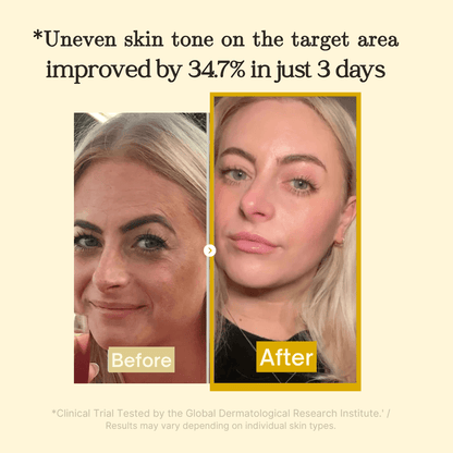 Dark Spot Corrector Face Mask | Overnight Peel-Off Brightening Treatment | 30ml