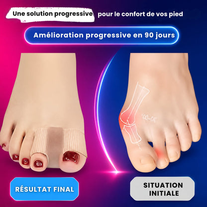 🎁 1 Acheté = 1 Offert | ToeAlign™ Correcteurs d'Orteils - Soulagez l'Hallux Valgus en Douceur ⭐