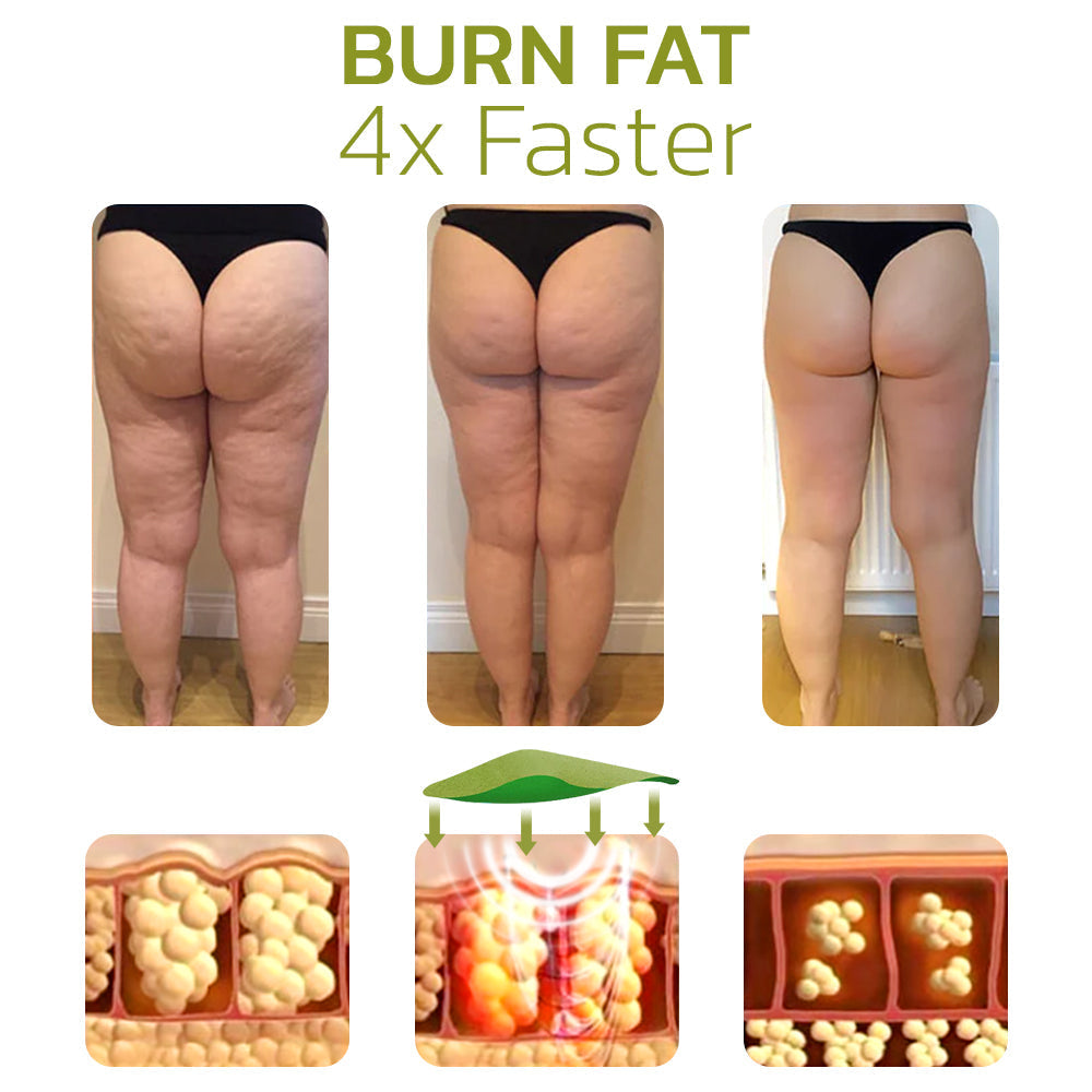 CelluClear™ Cellulite-Free Confidence