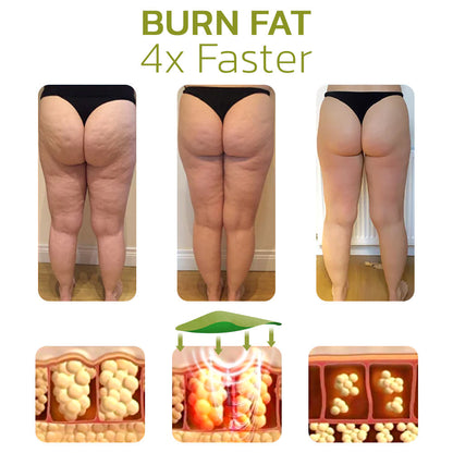 CelluClear™ Cellulite-Free Confidence