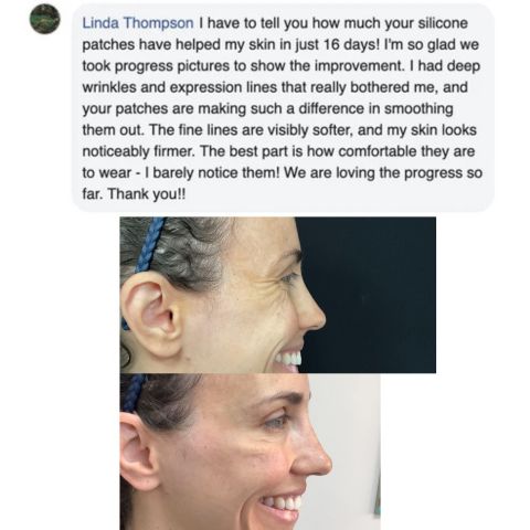 Reusable Anti-Wrinkle Face Patches | Silicone Wrinkle Pads for Forehead, Eyes & Smile Lines