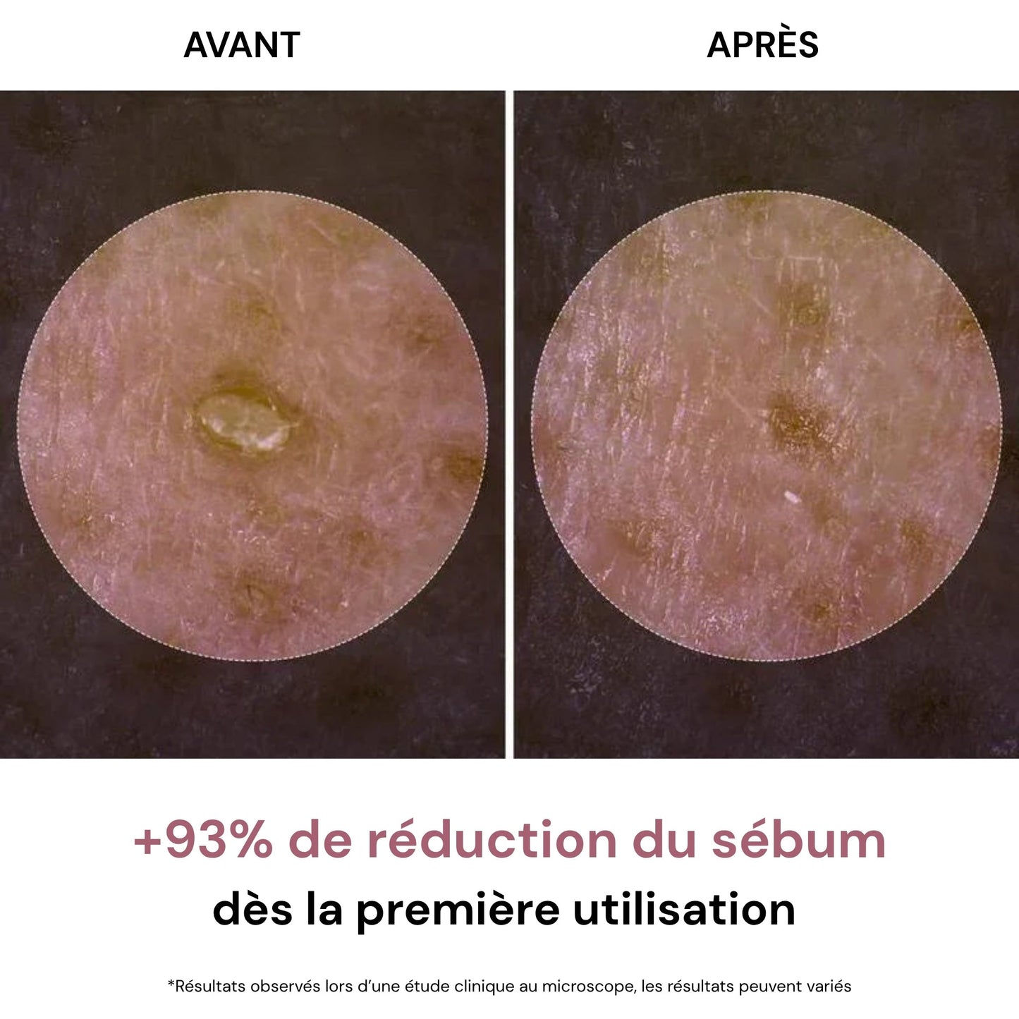 RiceGlow™ Duo Exfoliant Coréen au Riz | Peau Lisse & Éclatante