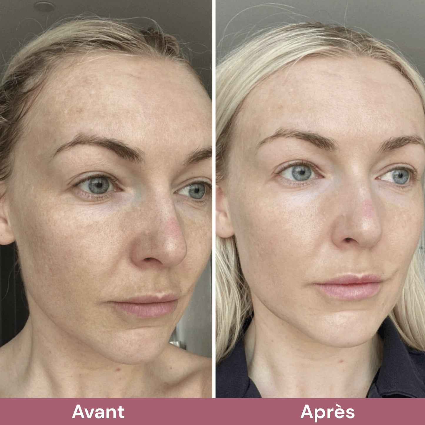 RiceGlow™ Duo Exfoliant Coréen au Riz | Peau Lisse & Éclatante