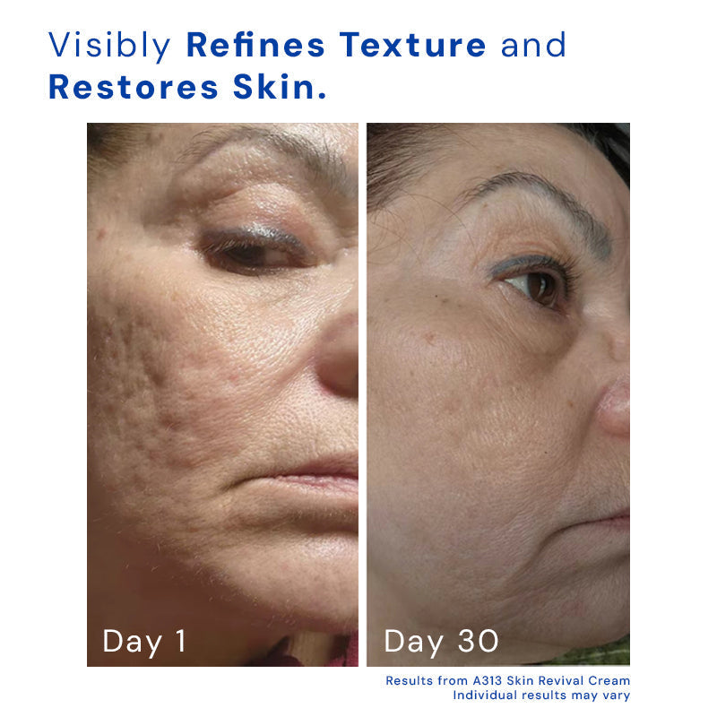 Anti-Aging Night Cream | Retinyl Palmitate & Vitamin A | Smooth Wrinkle Repair | Hydrating Formula