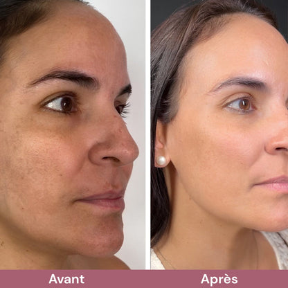 RiceGlow™ Duo Exfoliant Coréen au Riz | Peau Lisse & Éclatante