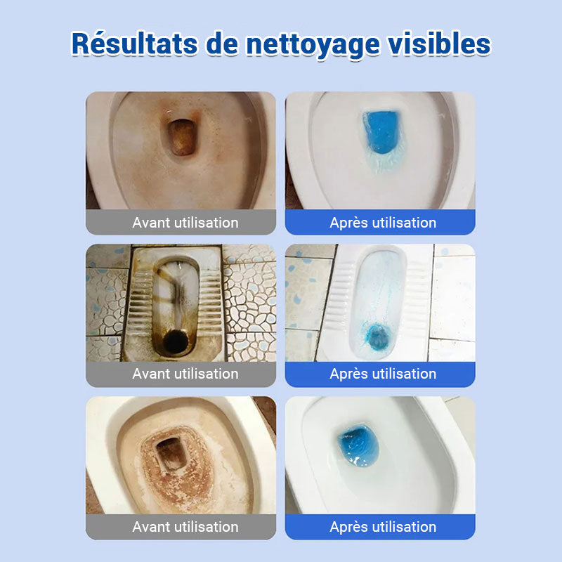 🎁 1+1 OFFERT ✅ UltraFlush™ Comprimés de Nettoyage et Désodorisants pour Toilettes