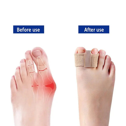 Toe Separators for Bunions & Misalignment | Elastic Nylon + SEBS | Pain Relief & Posture Support