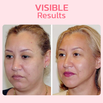 GlowLift™ Sculpted Jawline Enhancer