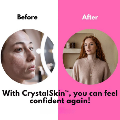 CrystalSkin™ – Une Peau Lisse et Éclatante Inspirée de la Corée du Sud