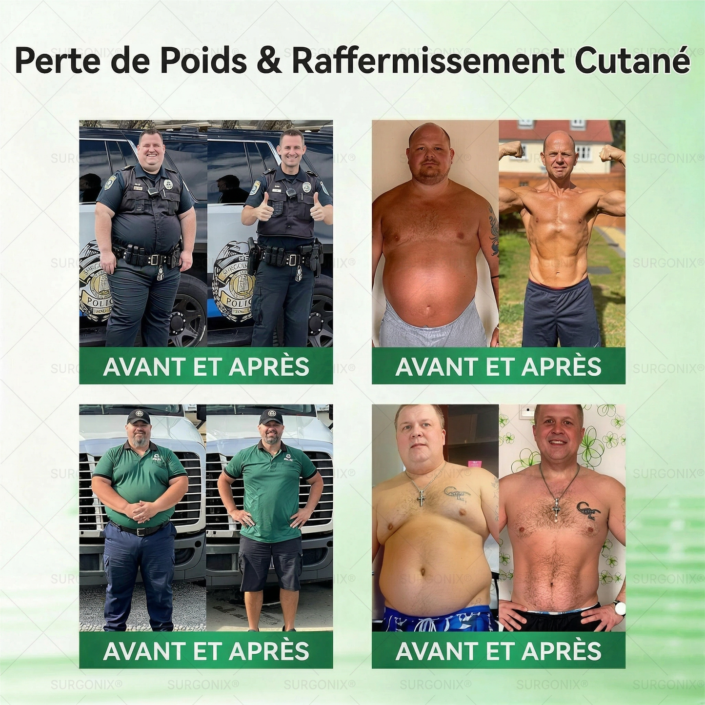 Surgonix® | Moringa, Berbérine & NAD+ | Patch transdermique 10-en-1 à micro-aiguilles | Soutien du métabolisme