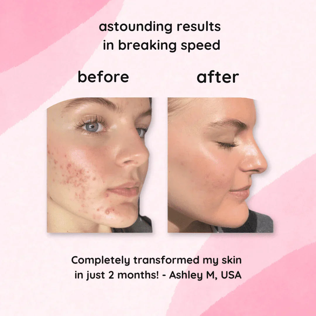 Velleara Turmeric & Kojic Acid Pads | 40 Pack | Reveal fresher, brighter skin — one pad at a time