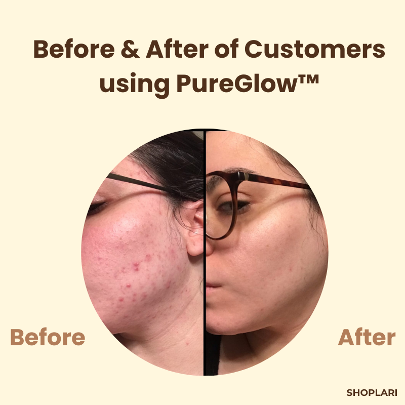 Facial Repair Mask | Black Tea & Ginseng | Anti-Acne, Hydrating & Brightening