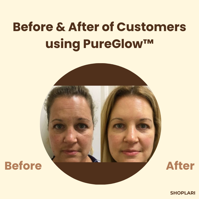 1+1 FREE | PureGlow™ - Black Tea Mask