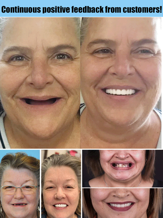 Premium Denture Set | Custom Mold Fit | Natural-Look False Teeth | Comfortable All-Day Wear