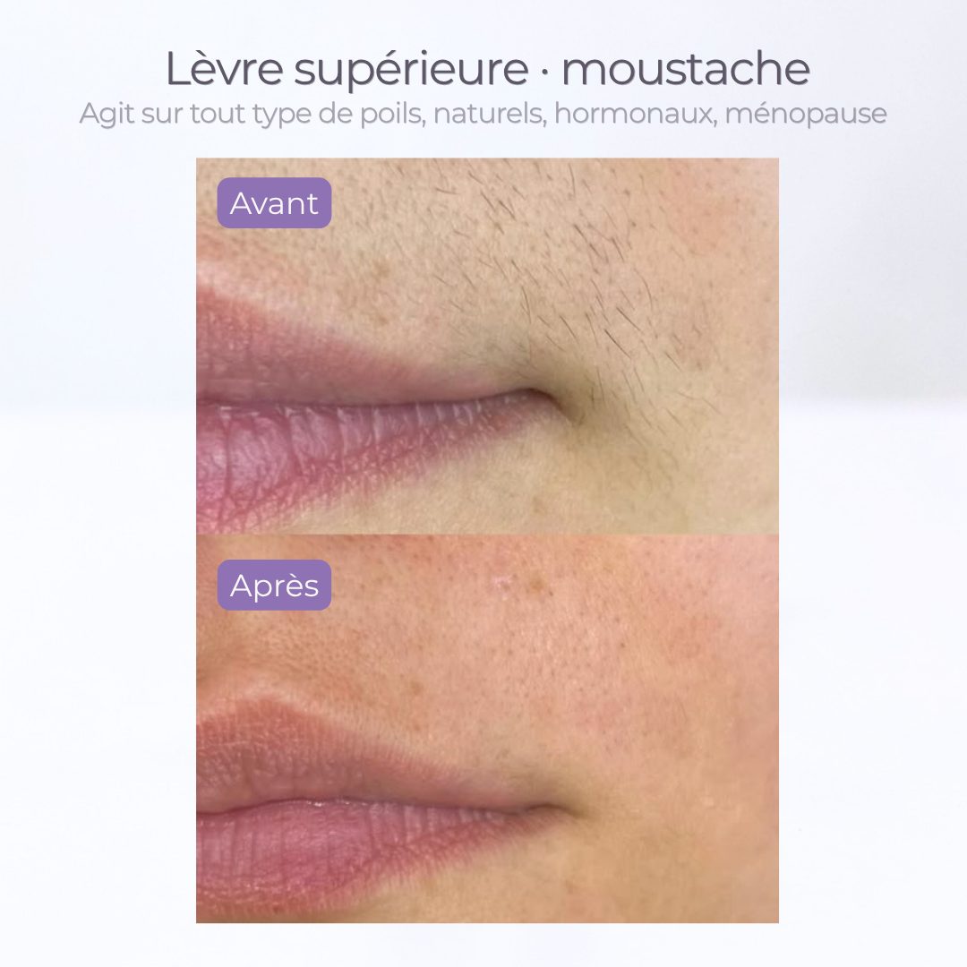 SÉRUM ANTI REPOUSSE POILS spécial visage