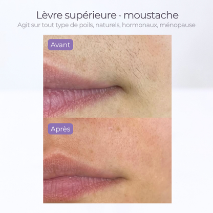 SÉRUM ANTI REPOUSSE POILS spécial visage