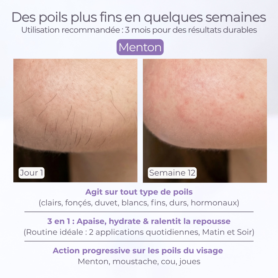 SÉRUM ANTI REPOUSSE POILS spécial visage