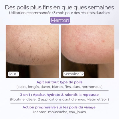 SÉRUM ANTI REPOUSSE POILS spécial visage