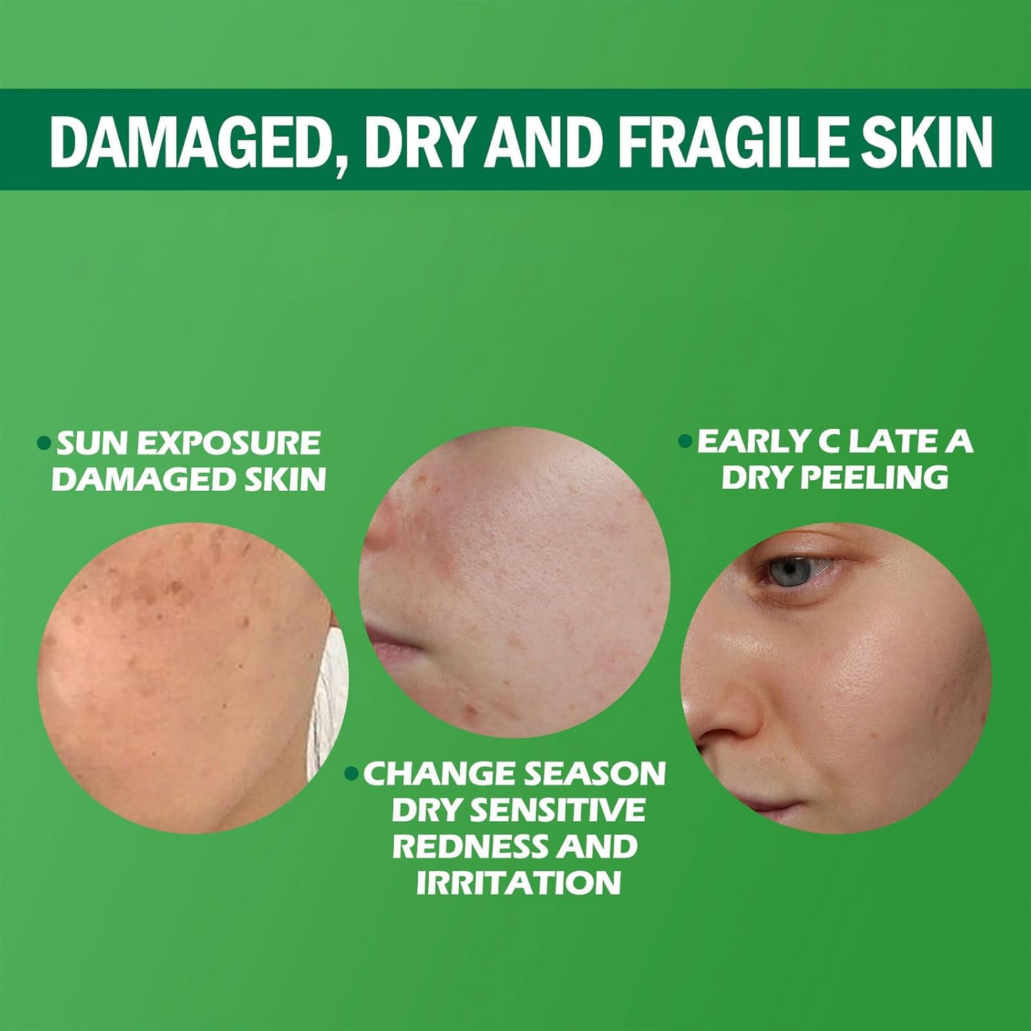 AvocadoDew™ Nature’s Skin Therapy in just 10 minutes