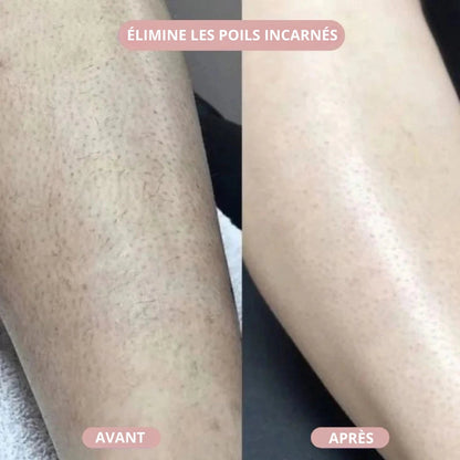 Éclat de Soie™ | Rasoir 2-en-1 pour femme pour une peau douce et soignée