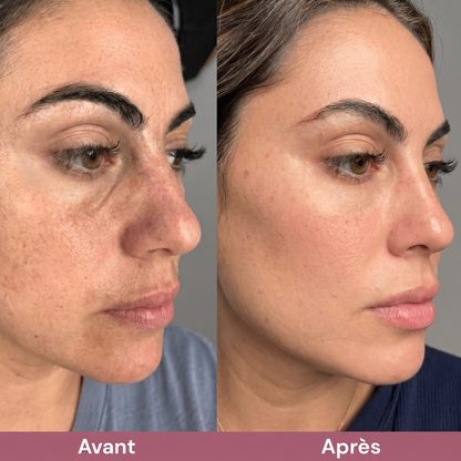 RiceGlow™ Duo Exfoliant Coréen au Riz | Peau Lisse & Éclatante
