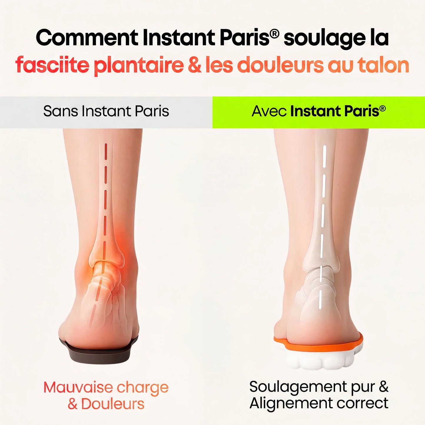 OrthoStep™ Semelles Orthopédiques de Soulagement