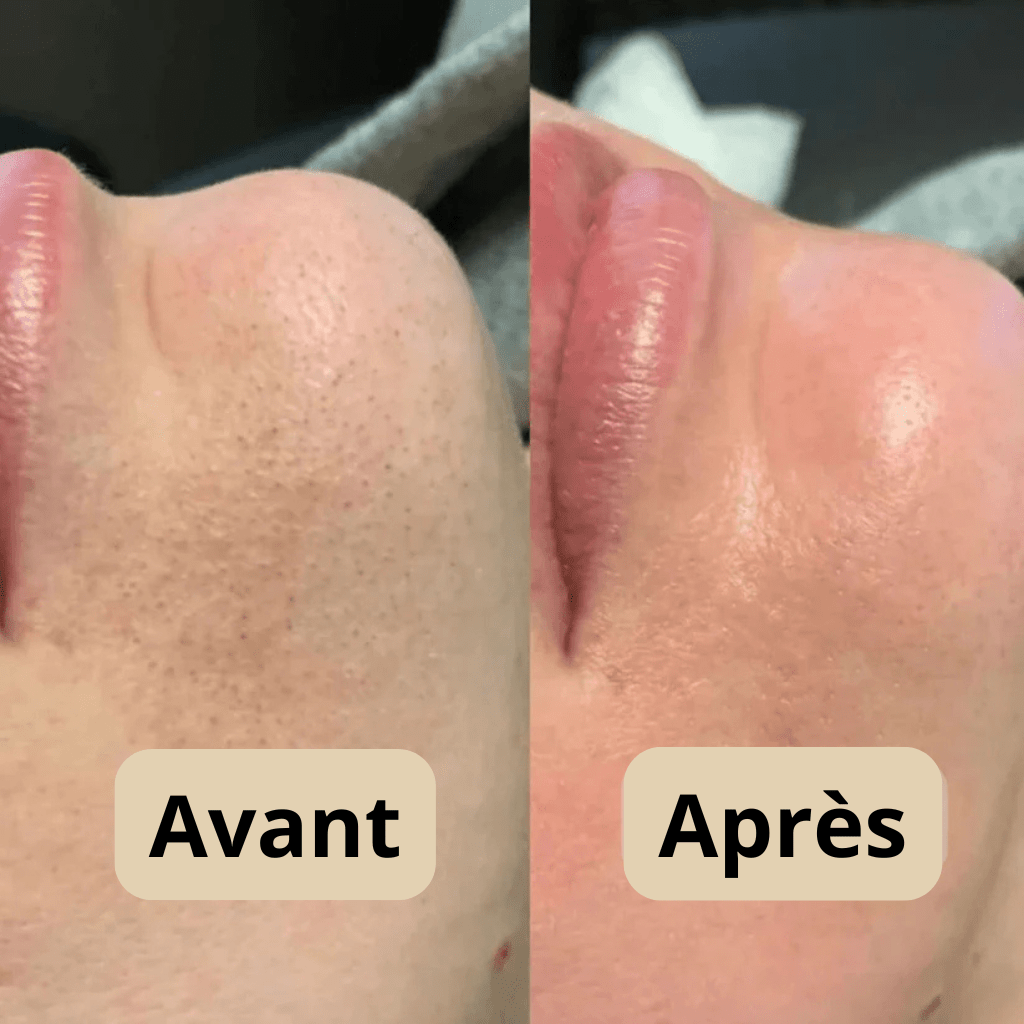 Peel Shot™ Gel Exfoliant Enzymatique pour le Visage