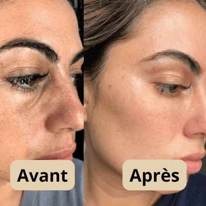 Peel Shot™ Gel Exfoliant Enzymatique pour le Visage
