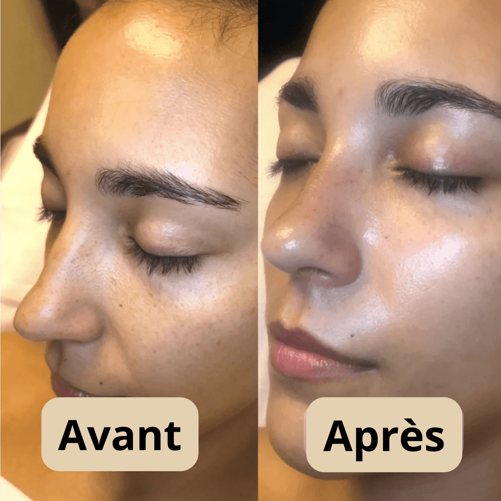 Peel Shot™ Gel Exfoliant Enzymatique pour le Visage