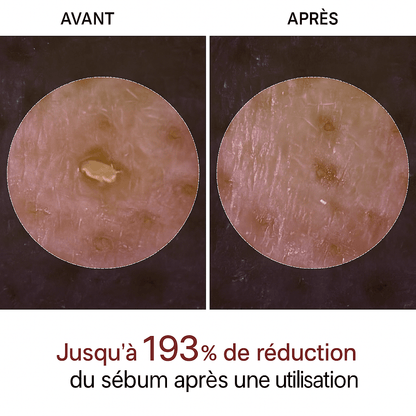 Peel Shot™ Gel Exfoliant Enzymatique pour le Visage